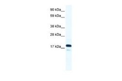 TAF9 Rabbit anti-Human, Polyclonal, Novus Biologicals 0.1ml; Unconjugated:Antibodies,